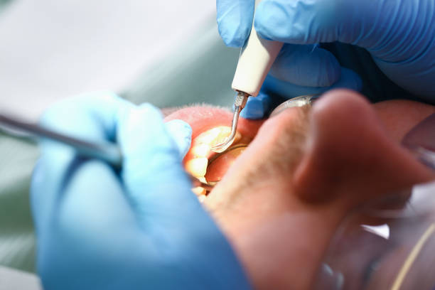 Best Emergency Orthodontic Repairs in Ocilla, GA