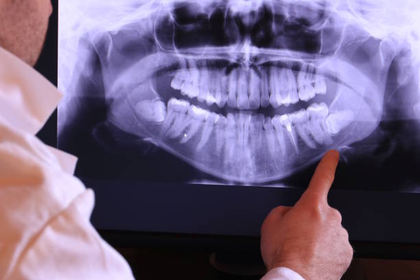 Best Emergency Treatment for Toothache in Ocilla, GA